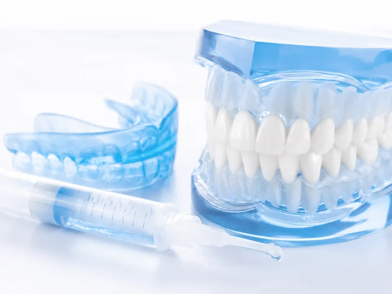 Teeth whitening treatment